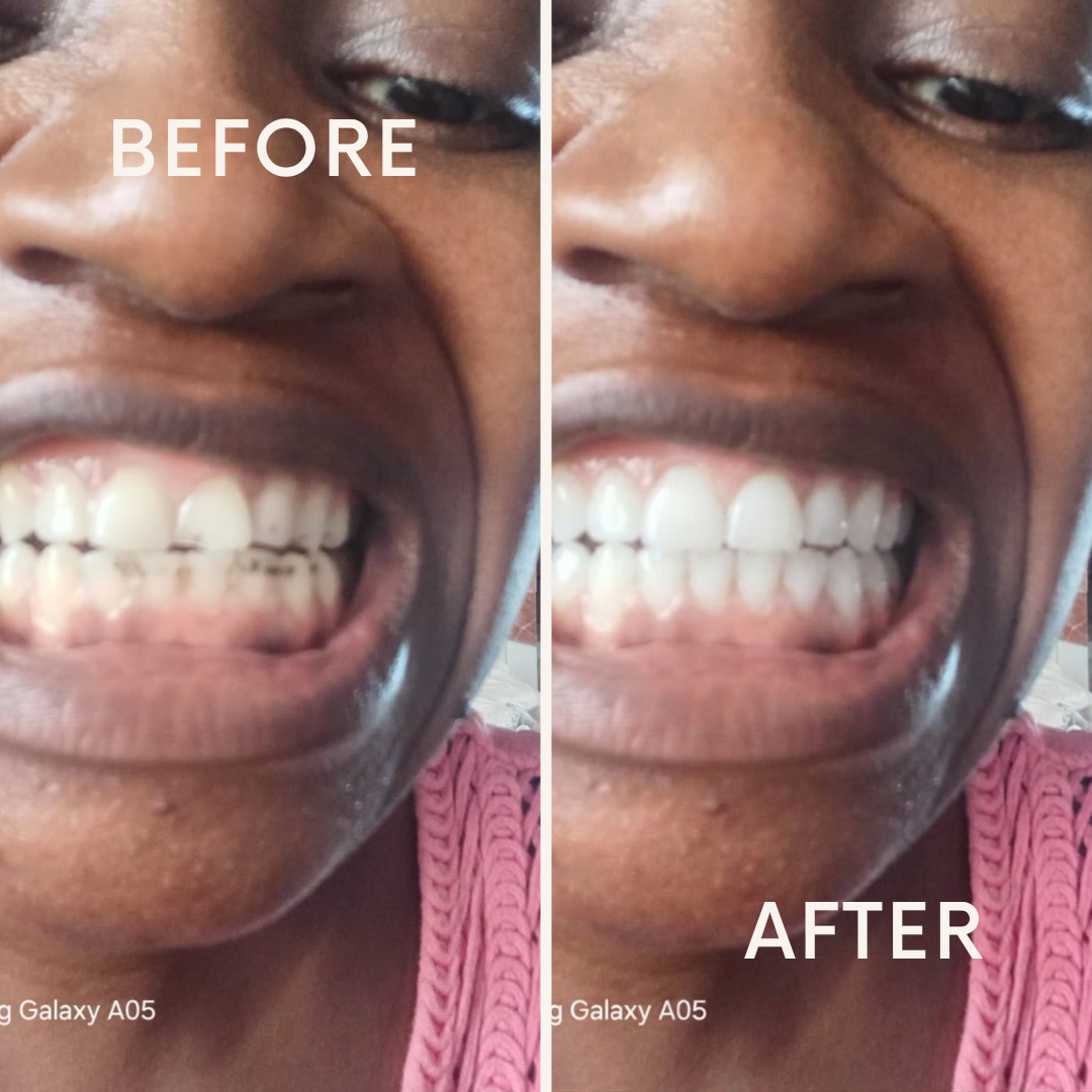 Marre des dents jaunes ?a partir de la 1ere utilisation.  Profitez de l’offre ➡️ 02 tubes acheter = 01 tube offert