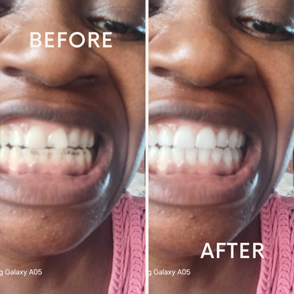 Marre des dents jaunes ?a partir de la 1ere utilisation.  Profitez de l’offre ➡️ 02 tubes acheter = 01 tube offert