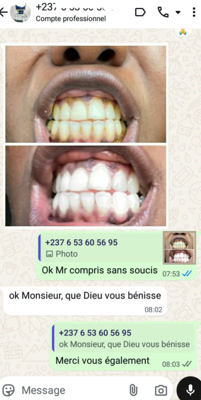 Marre des dents jaunes ?a partir de la 1ere utilisation.  Profitez de l’offre ➡️ 02 tubes acheter = 01 tube offert